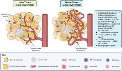 Obesity and leptin in breast cancer angiogenesis